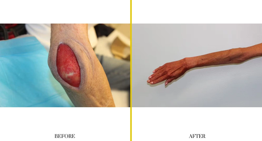 Extremity Reconstruction (11)