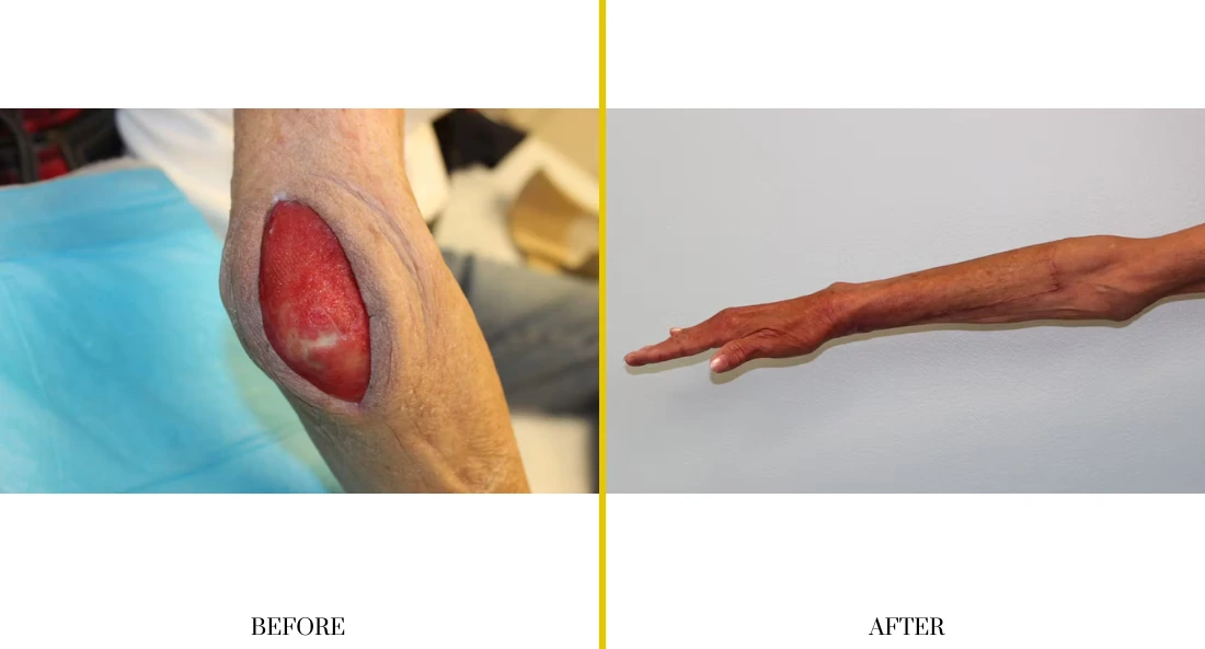 Extremity Reconstruction (12)