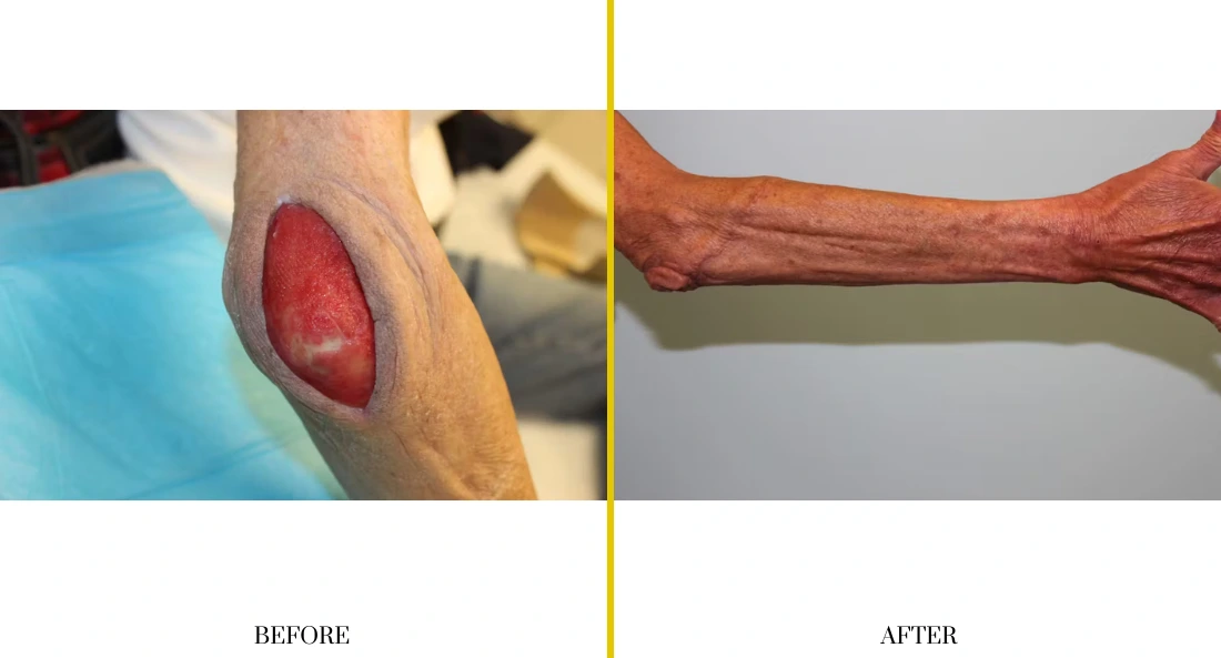 Extremity Reconstruction (13)