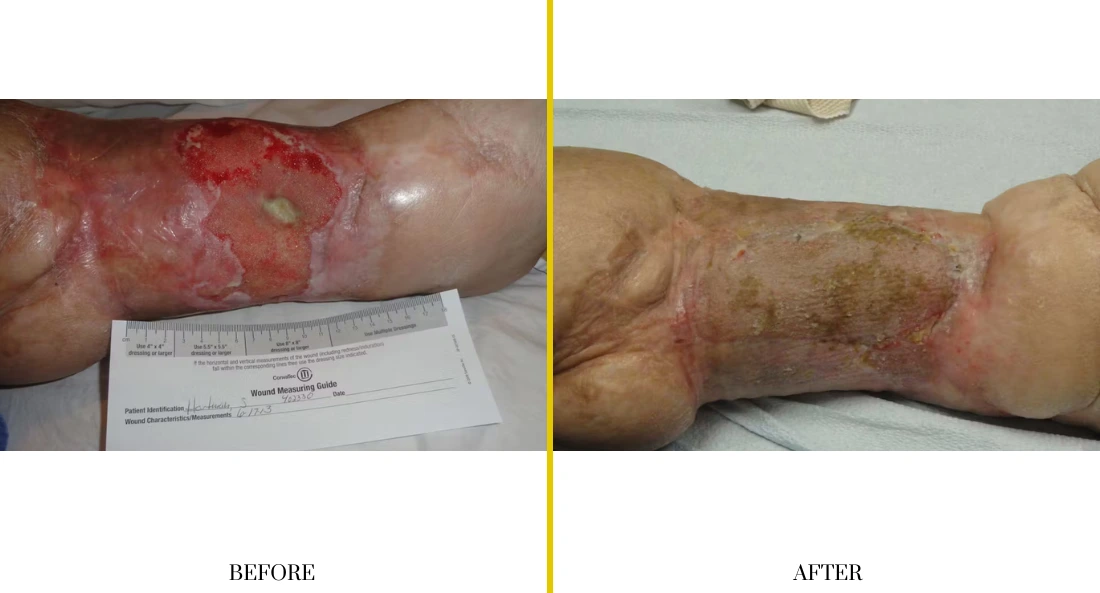 Extremity Reconstruction (23)