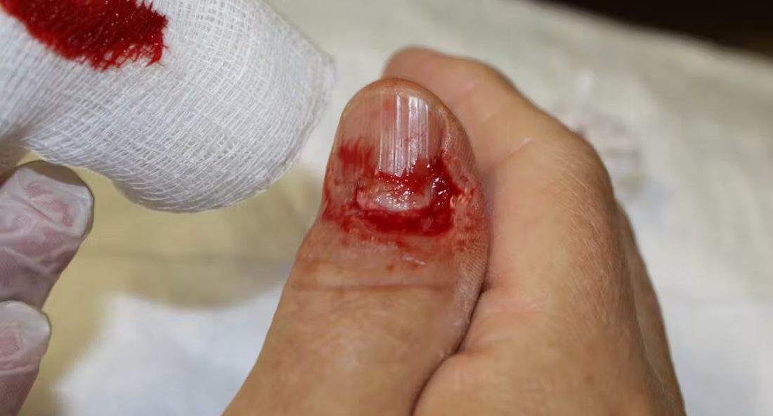Extremity Reconstruction (58)