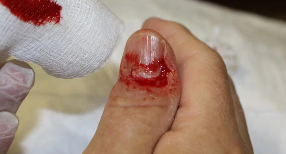 Extremity Reconstruction (58)