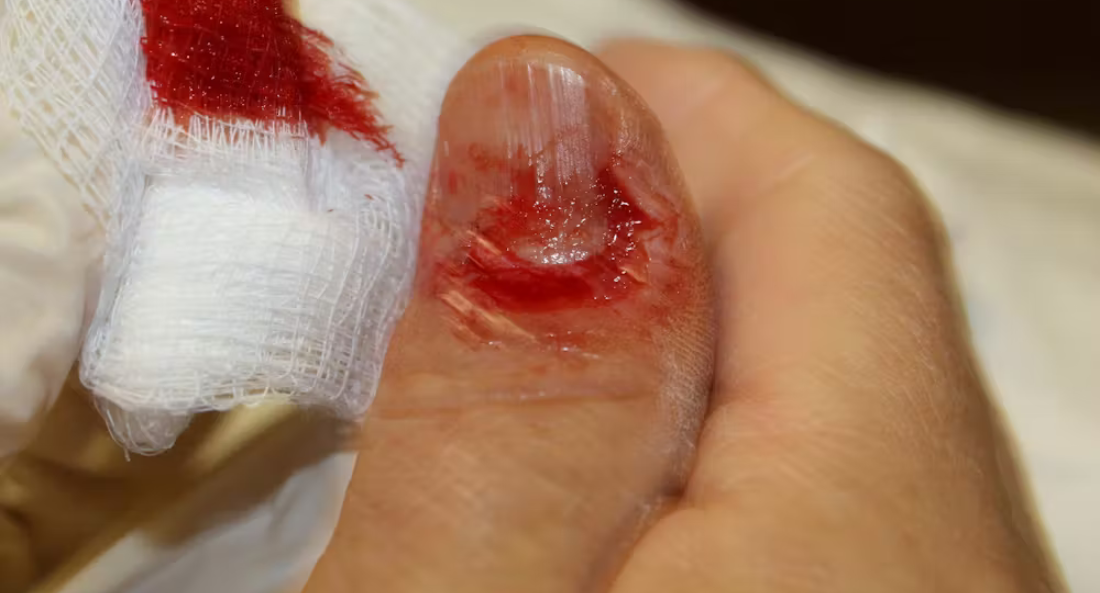 Extremity Reconstruction (59)