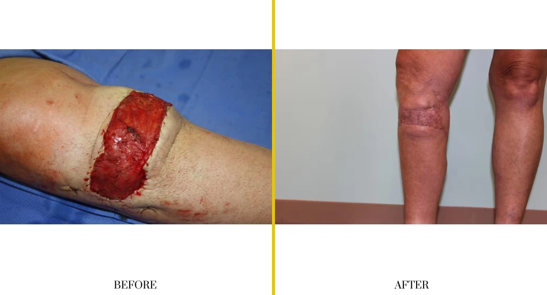 Extremity Reconstruction (6)