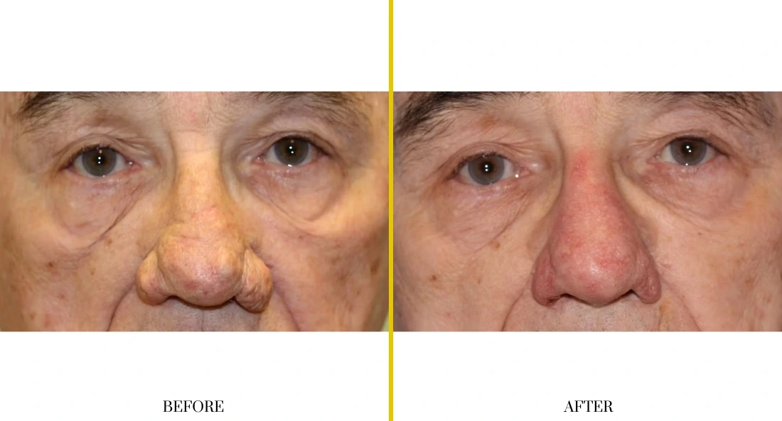Extremity Reconstruction (69)
