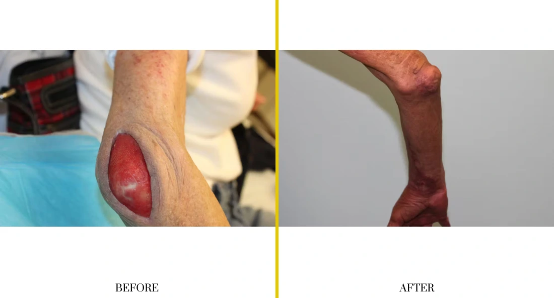 Extremity Reconstruction (7)