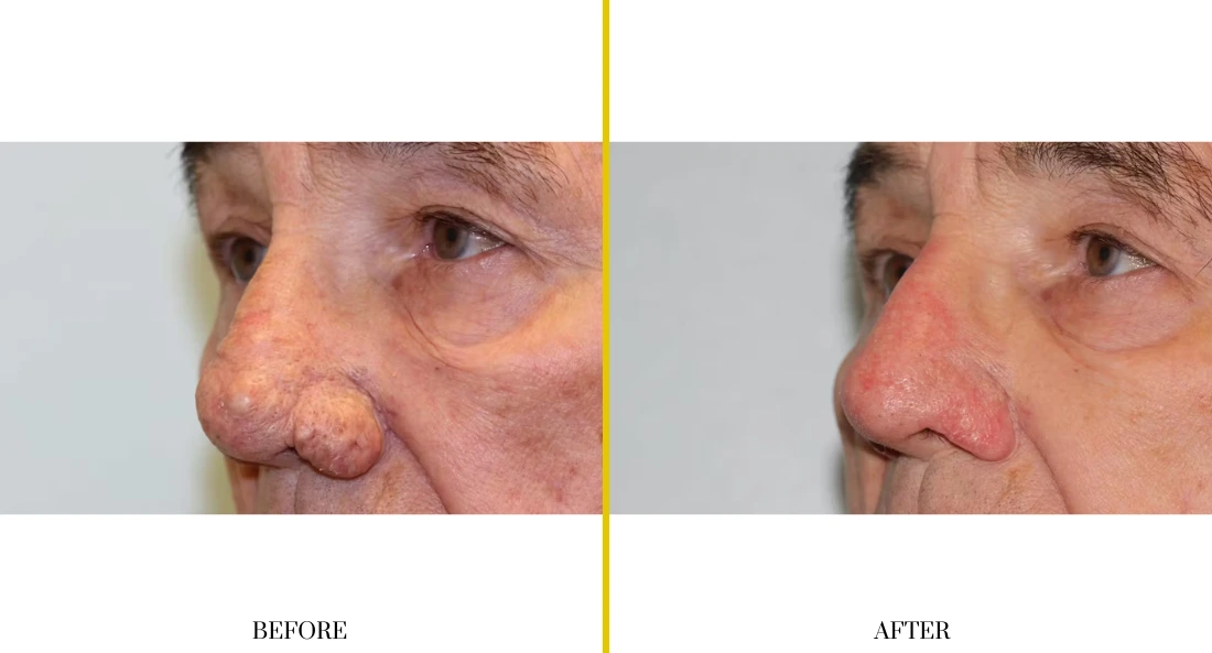 Extremity Reconstruction (70)