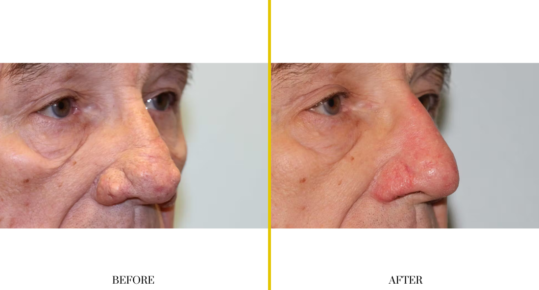 Extremity Reconstruction (71)