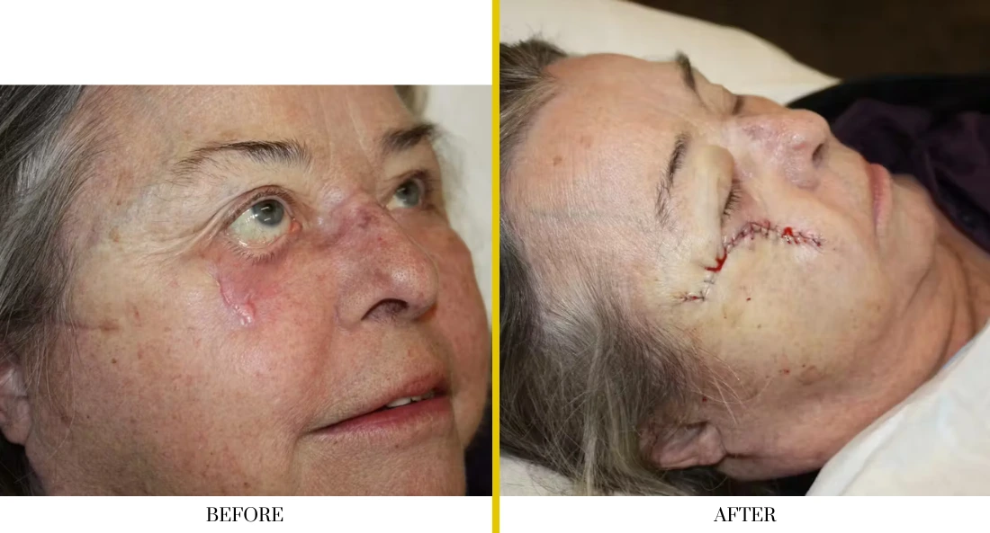 Facial (1)