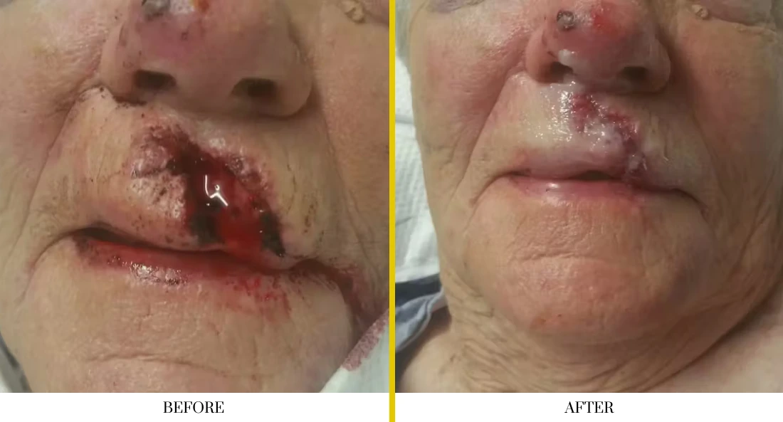 Facial (12)