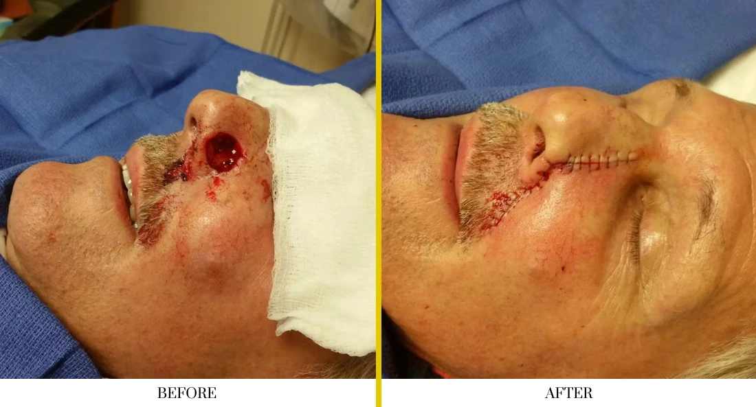 Facial (13)