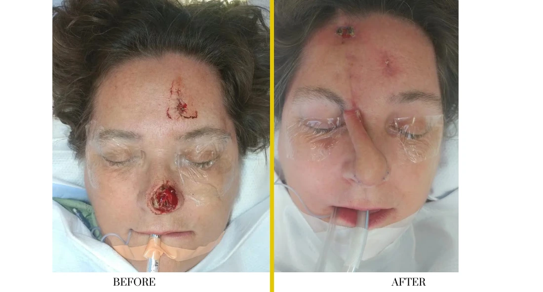 Facial (28)