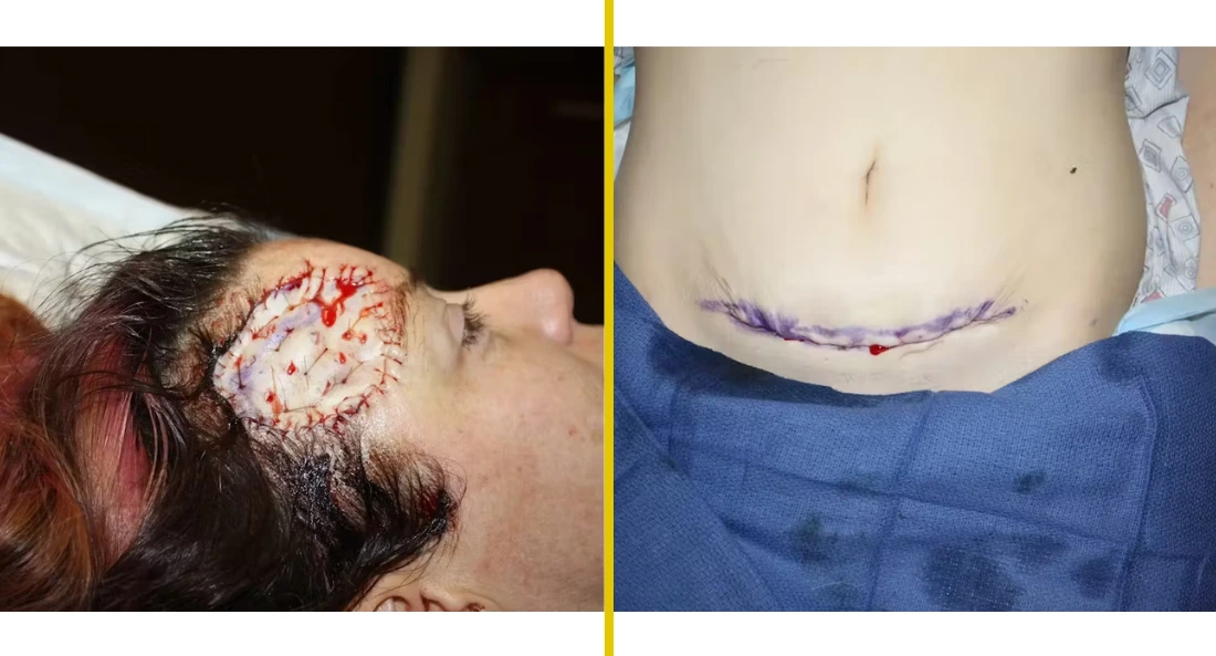 Facial (32)