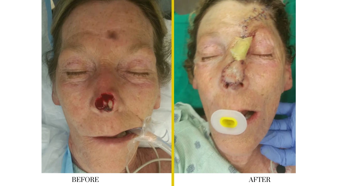 Facial (4)