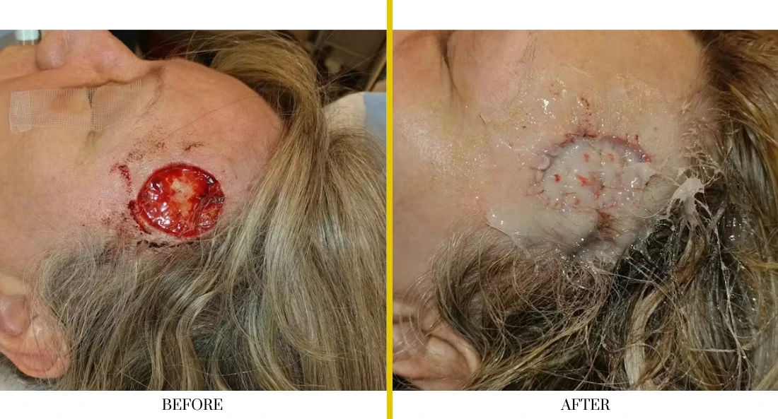 Facial (40)