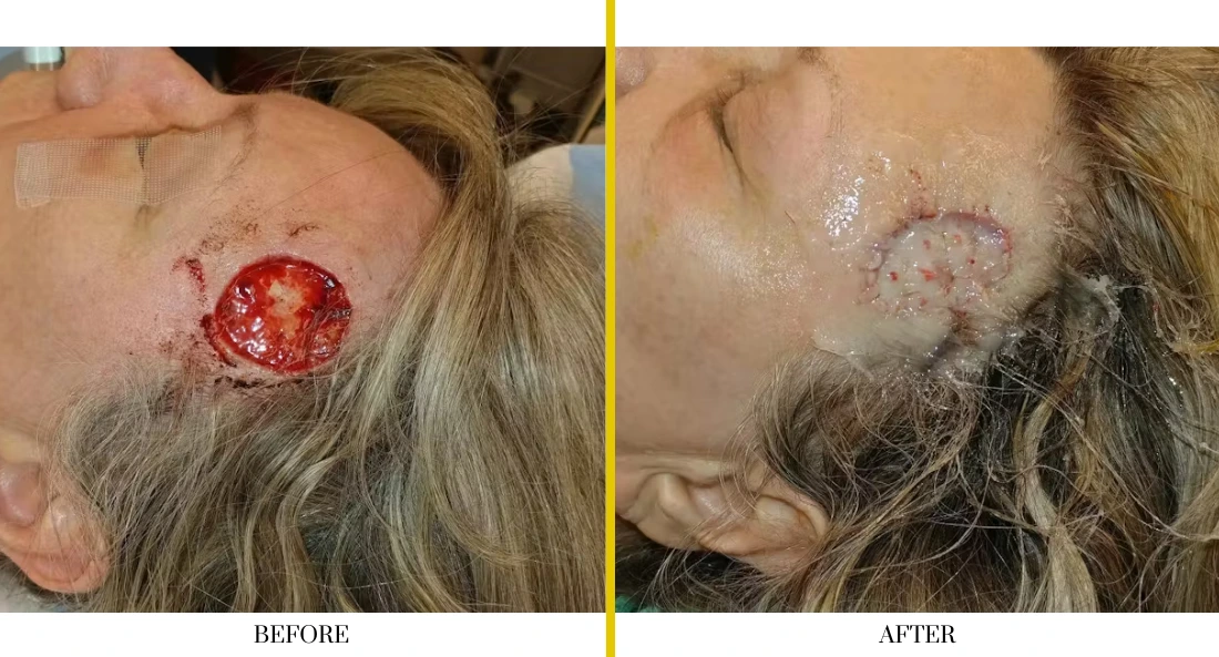 Facial (41)