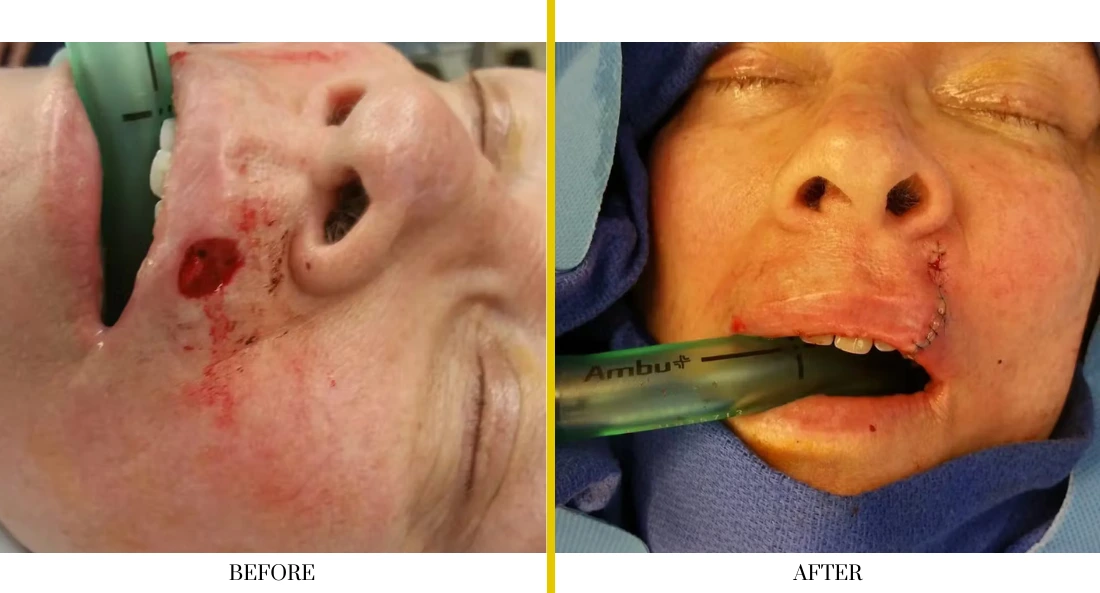 Facial (42)