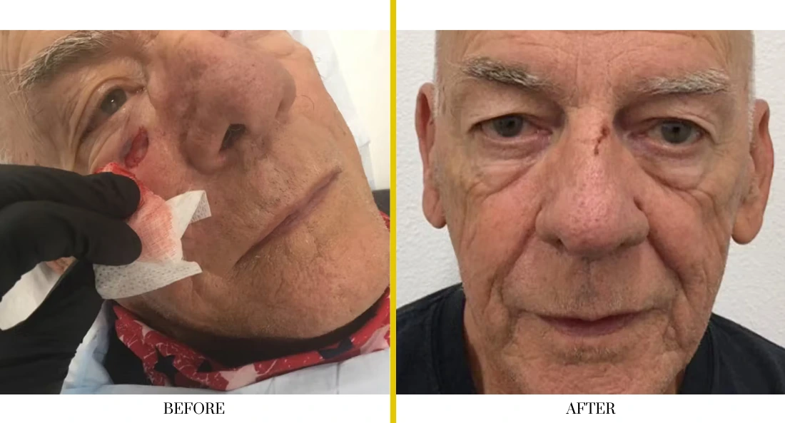 Facial (44)