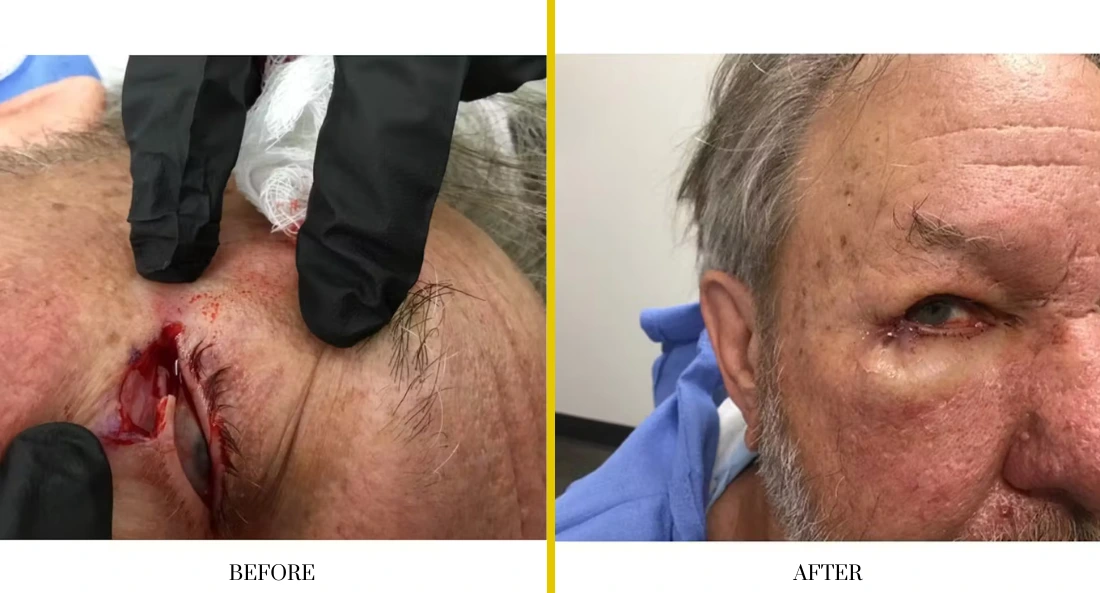 Facial (45)