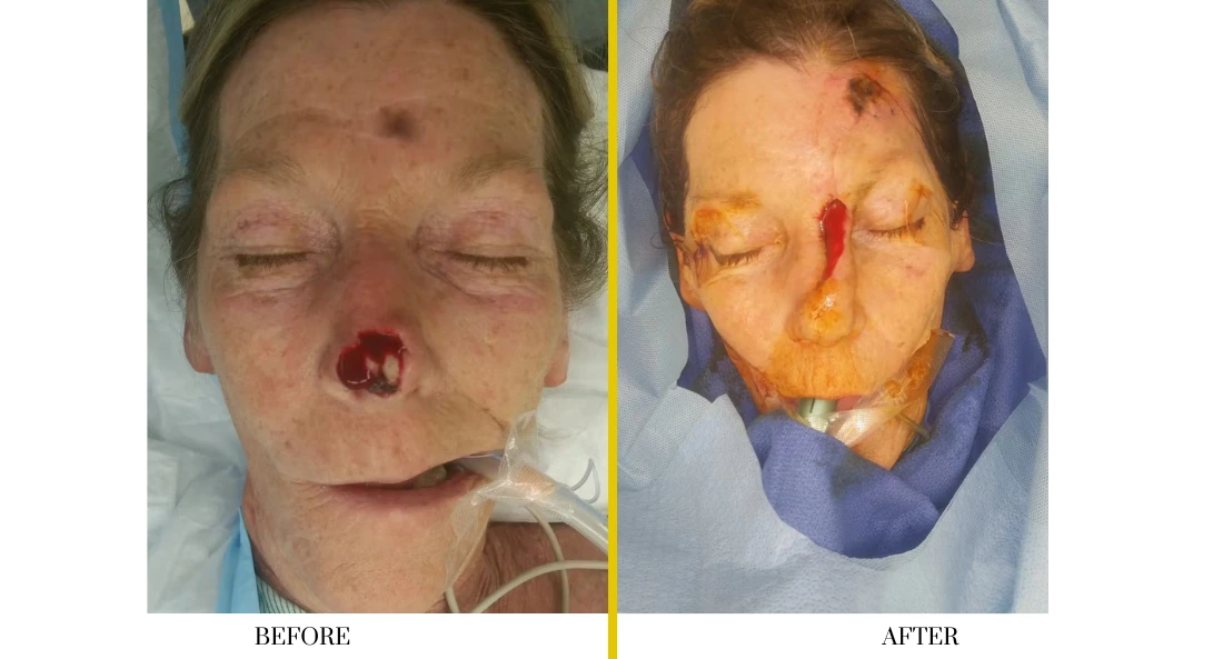 Facial (5)