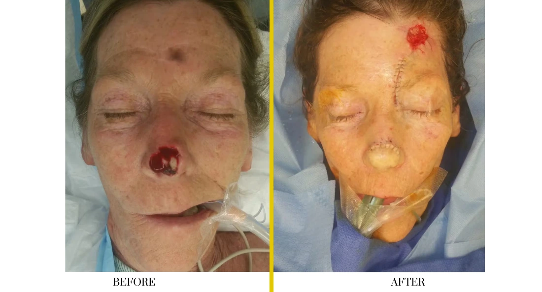 Facial (6)