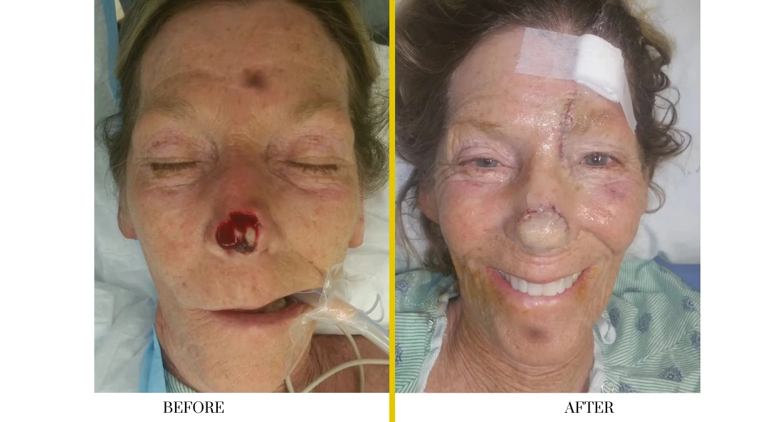 Facial (7)