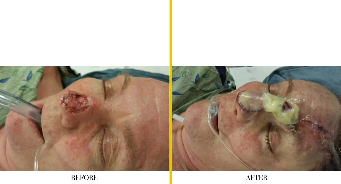 Facial (8)