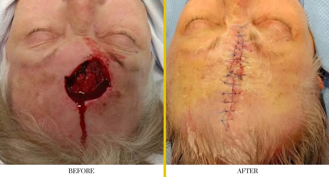 Facial (9)