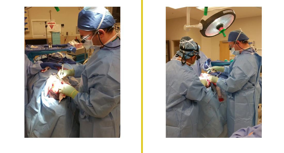 Skull Reconstruction and Cranioplasty (6)