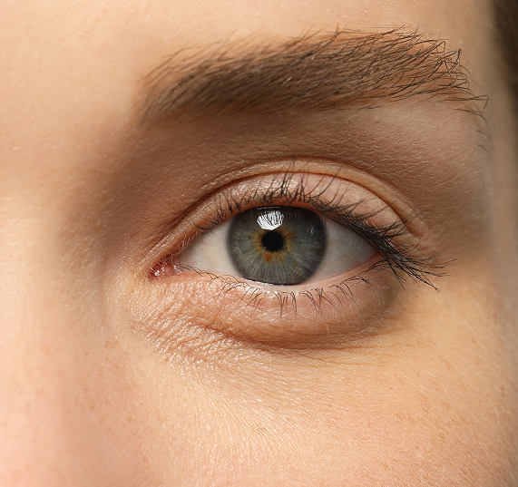 Results of Eyelid Lift Banner