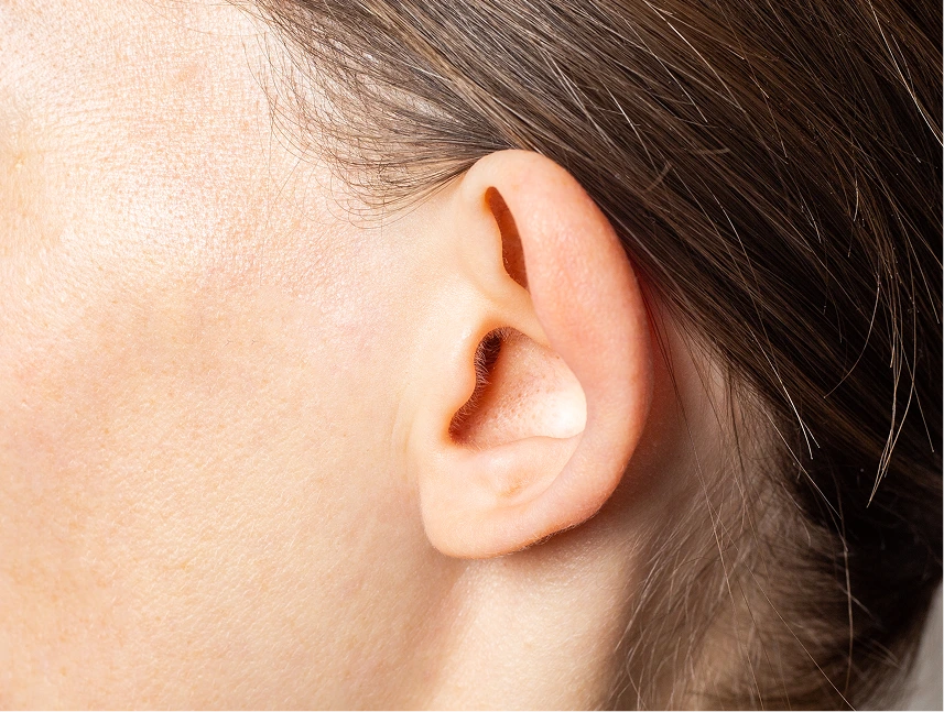What Is Otoplasty (Ear Surgery)? Banner