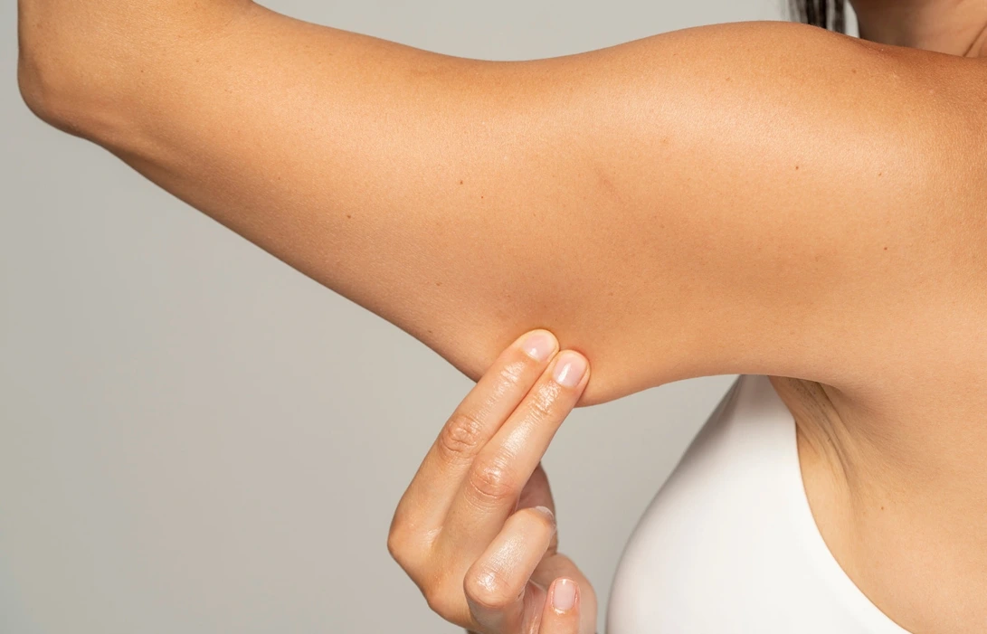 Arm Lift Surgery in Phoenix, AZ Banner