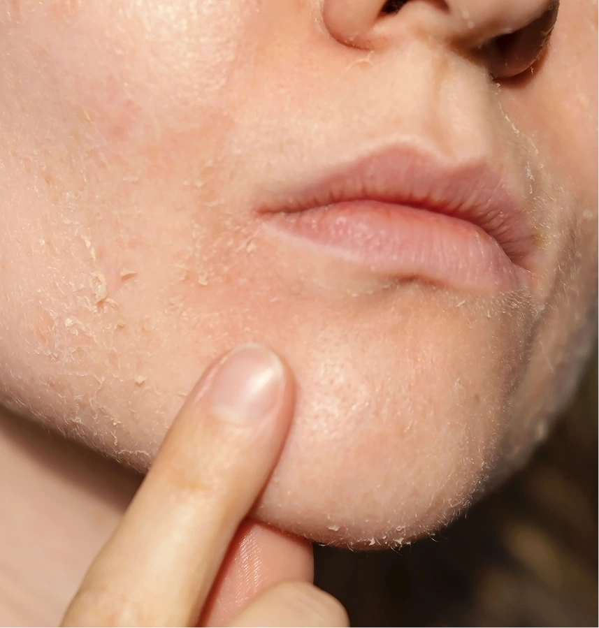 Diabetes Skin Conditions Treatment in Phoenix, AZ Banner