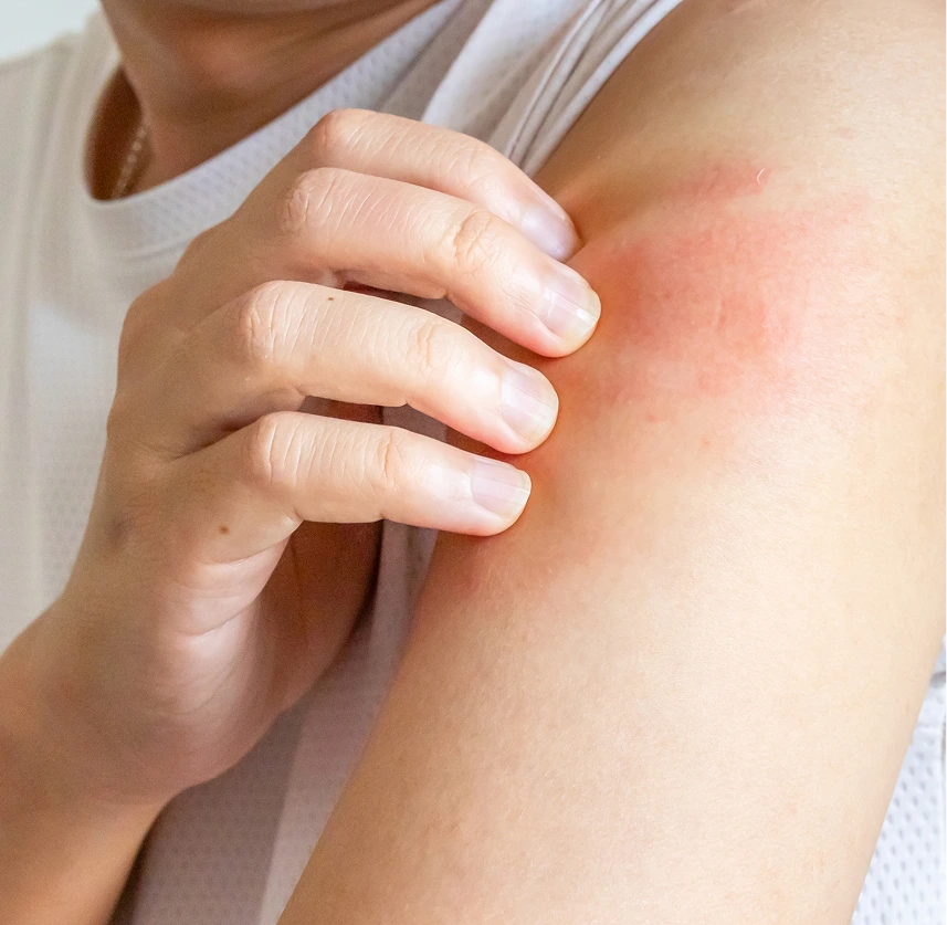 Diabetic Skin Condition Treatment Phoenix Banner