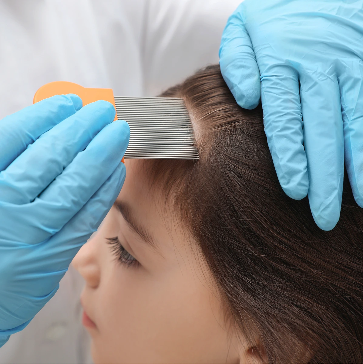 Head Lice Treatment in Phoenix, AZ Banner