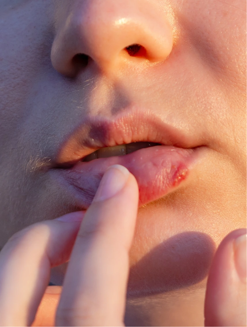 Herpes Treatment in Phoenix, Arizona Banner